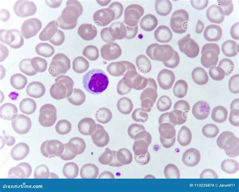 Subset Lymphocyte Cell T-এর ছবি ফলাফল