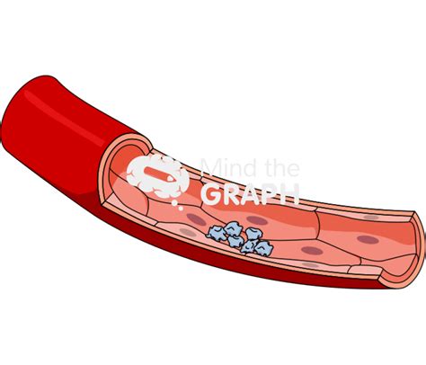 Platelet Aggregation Study Graph に対する画像結果