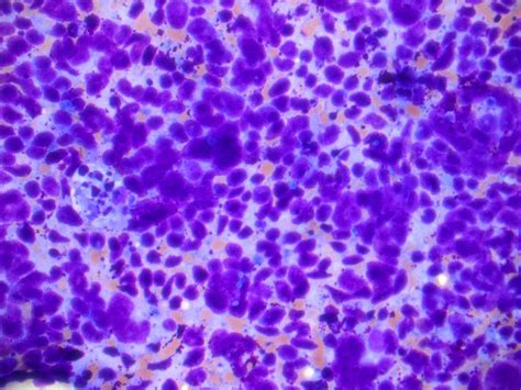 Afbeeldingsresultaten voor Merkel Cell Light Microscopy