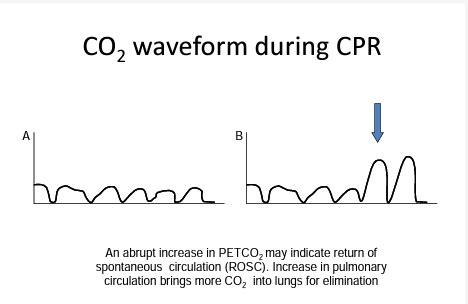 Toradh íomhá ar Normal Capnography Waveform