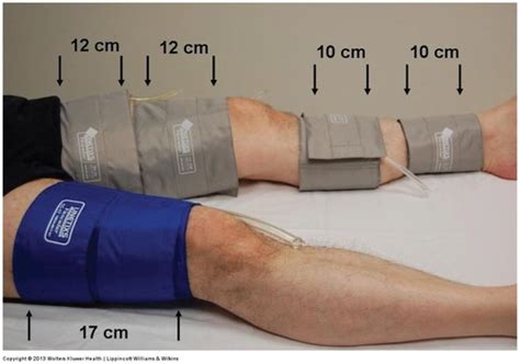 Pressure Gradient Segmental Pressure Lower Extremity に対する画像結果