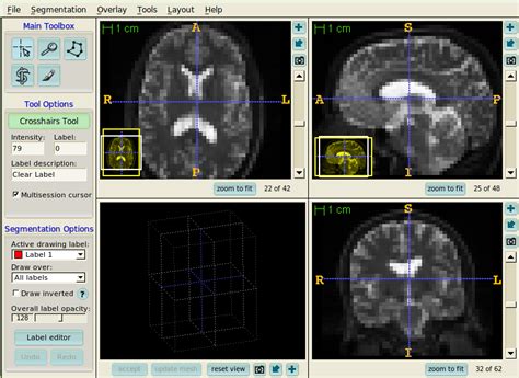 Image result for Simple ITK in MATLAB Code Example