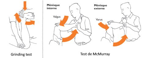 Toradh íomhá ar Dial Test Genou