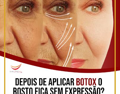 Botox Day Flyer-এর ছবি ফলাফল