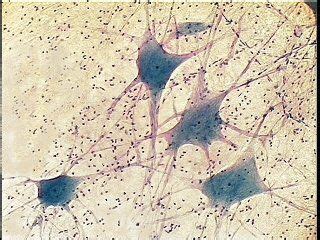 Image result for Giant Multipolar Neuron Microscope