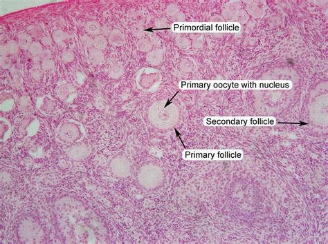 Ooctye Labeled に対する画像結果