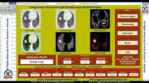 Lung Cancer Detection Using Image Processing GitHub కోసం చిత్ర ఫలితం