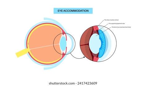 Toradh íomhá ar Eye Diagram That Shos Distant Light Refraction