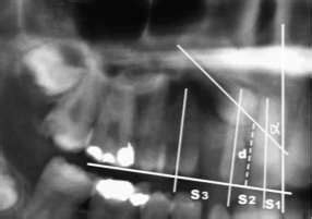 Image result for Bayesian Network Analysis