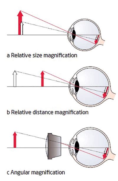 Angular Magnification に対する画像結果