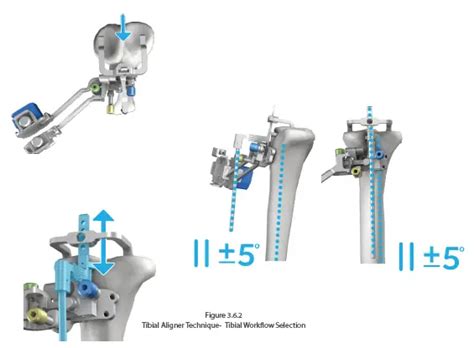 Afbeeldingsresultaten voor Computer Assisted Instrument Definition