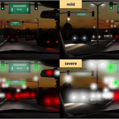 Toradh íomhá ar Multifocal IOL Color Contrast