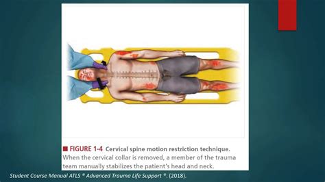 Atls Algorithm Poster に対する画像結果