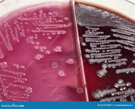 Image result for Coliform On MacConkey Agar