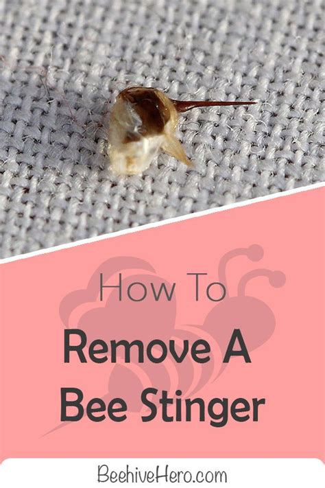 Image result for How to Remove a Bee Stinger