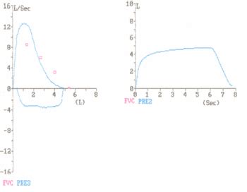 Image result for Pulmonary Function Test Flow Loop