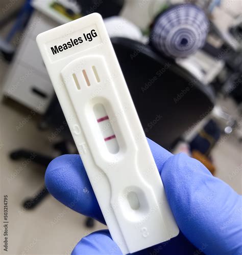 Image result for Test Lab IG BBG