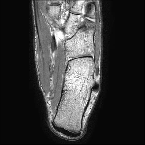 Image result for Normal MRI Axial View