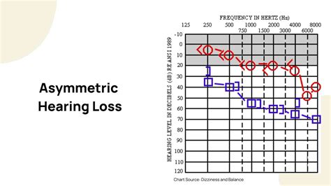 Afbeeldingsresultaten voor How to Operate an Audiogram Test