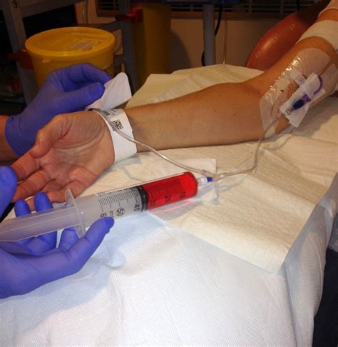 Image result for Pick Line for Chemotherapy Infusion