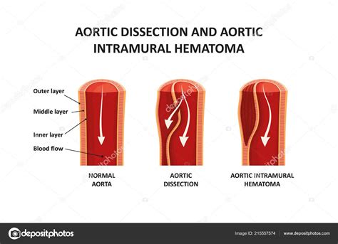 Medical Dissection に対する画像結果