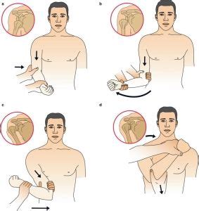 Image result for Anterior Shoulder Reduction Technique