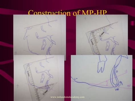 Image result for Perpendicular Cogs