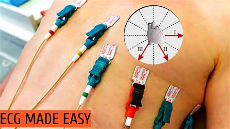 Image result for How to Use ECG Machine