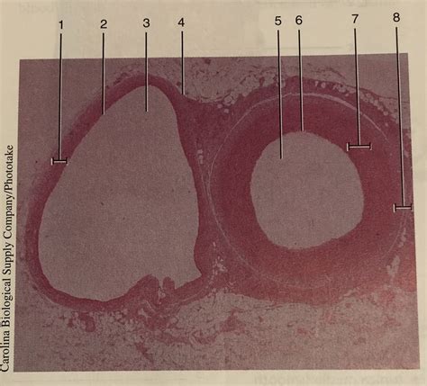 Transverse Section of Vein and Artery に対する画像結果