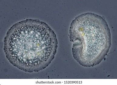 Phase Contrast Microscopy に対する画像結果