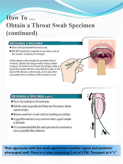 Swab Test Sample に対する画像結果