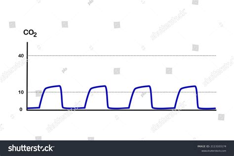 Toradh íomhá ar Normal Capnography Waveform