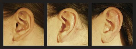 Different Ear Shapes Human に対する画像結果