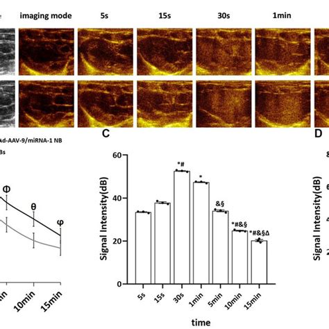 Image result for Echo Ultrasound Contrast