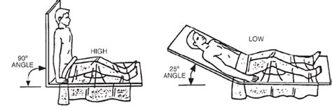 Image result for What Does High Fowler's Look Like