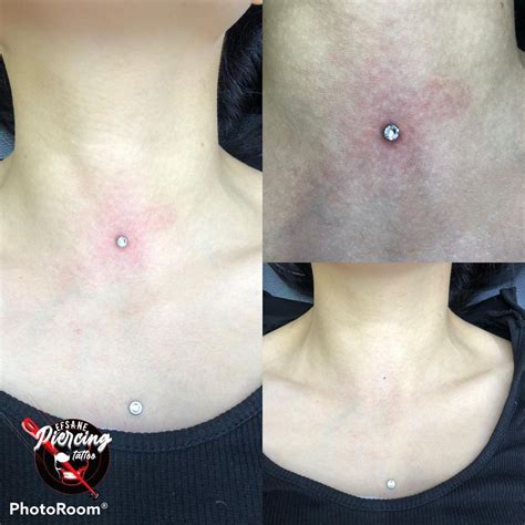 Dermal Piercing Face Scar