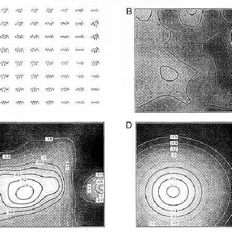 EEG Array に対する画像結果