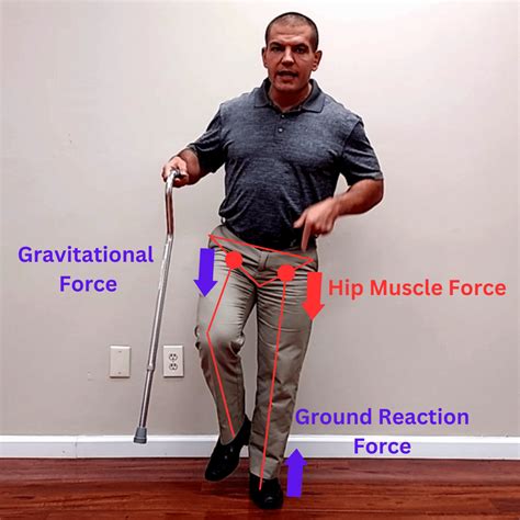 How To Use A Cane For Hip Bursitis at Victoria Mcbrien blog