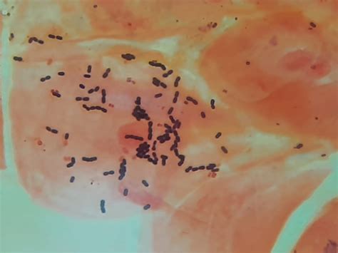 Image result for Strep Gram-positive