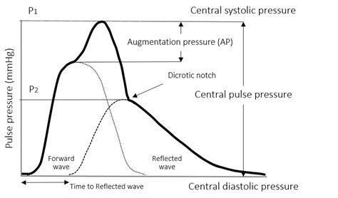 Image result for Digoxin Pulse Waveform