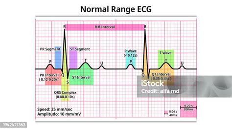 Toradh íomhá ar Normal QT Interval ECG