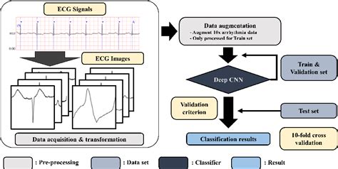 Afbeeldingsresultaten voor ECG Signal Deep Learning Model
