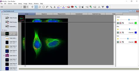 Image result for Only Cells Software for Microscopy