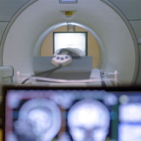 Toradh íomhá ar Brain Activity Decoder Device