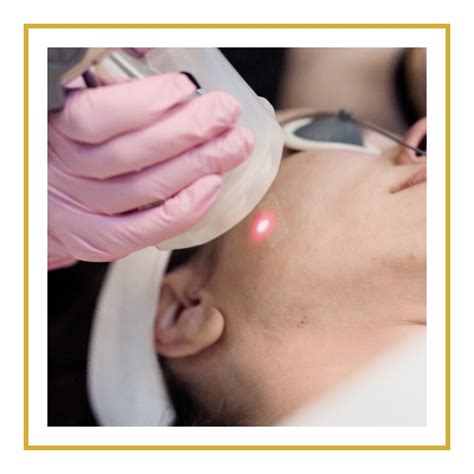 Afbeeldingsresultaten voor Micro Nano Laser Processing