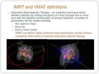 Image result for Optimization Only Structures IMRT