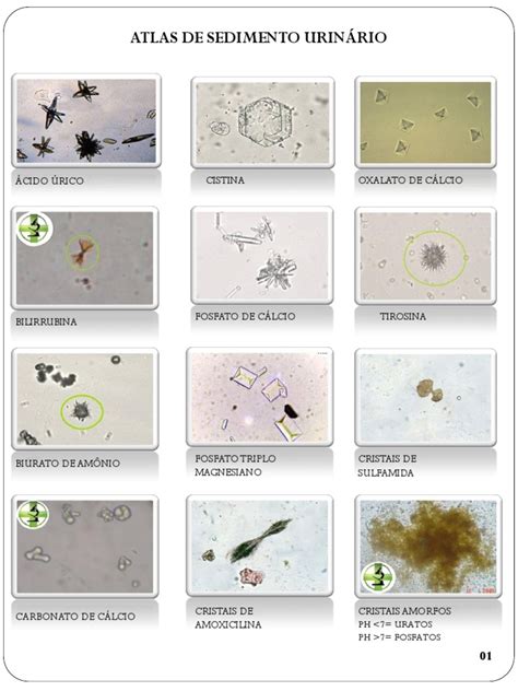 Urine Atlas PDF Book के लिए छवि परिणाम