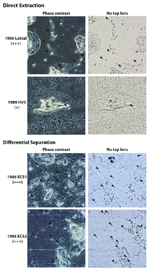 Image result for Phase Contrast Microscope Slides