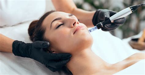 Afbeeldingsresultaten voor Micro Needling Pen with RF