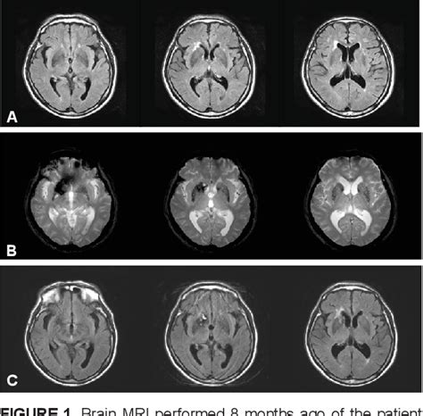 Toradh íomhá ar Computer Memory Crying